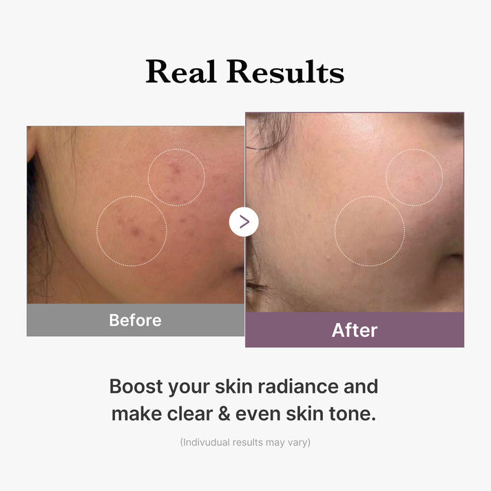 MEDICUBE AGE-R Glutathione Glow Toner - 140ml